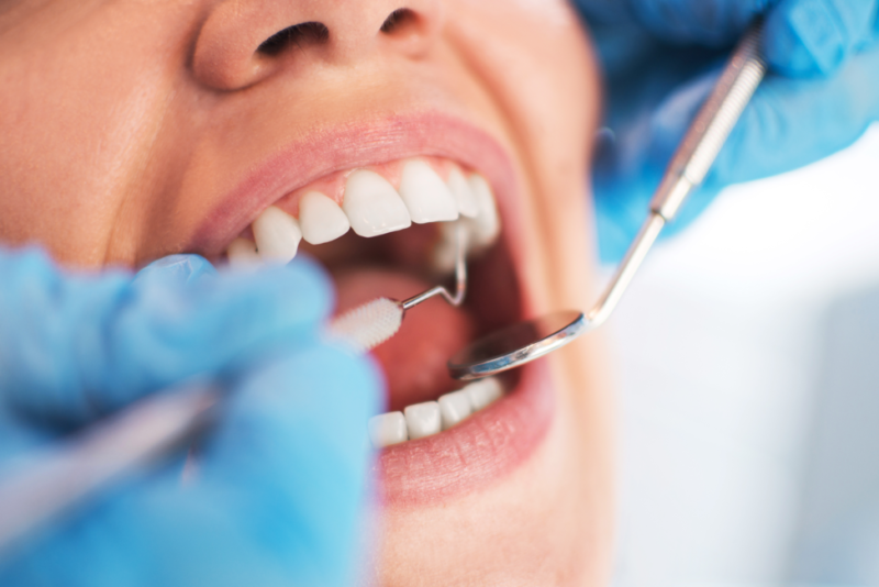 5 Tips to Affording Dental Care