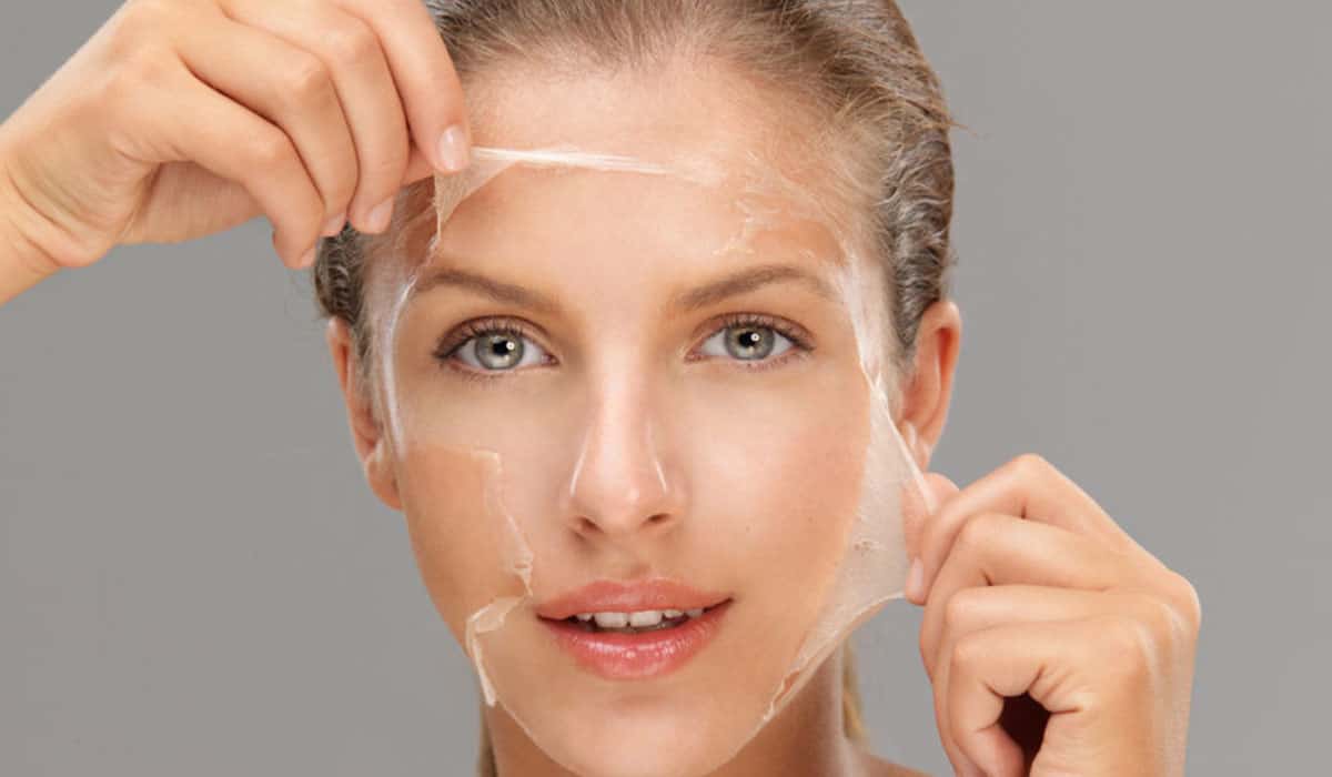 TCA Chemical Peel Can Help Improve Your Skin